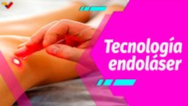 Buena Vibra | Descubre los beneficios del endoláser para tu cuerpo